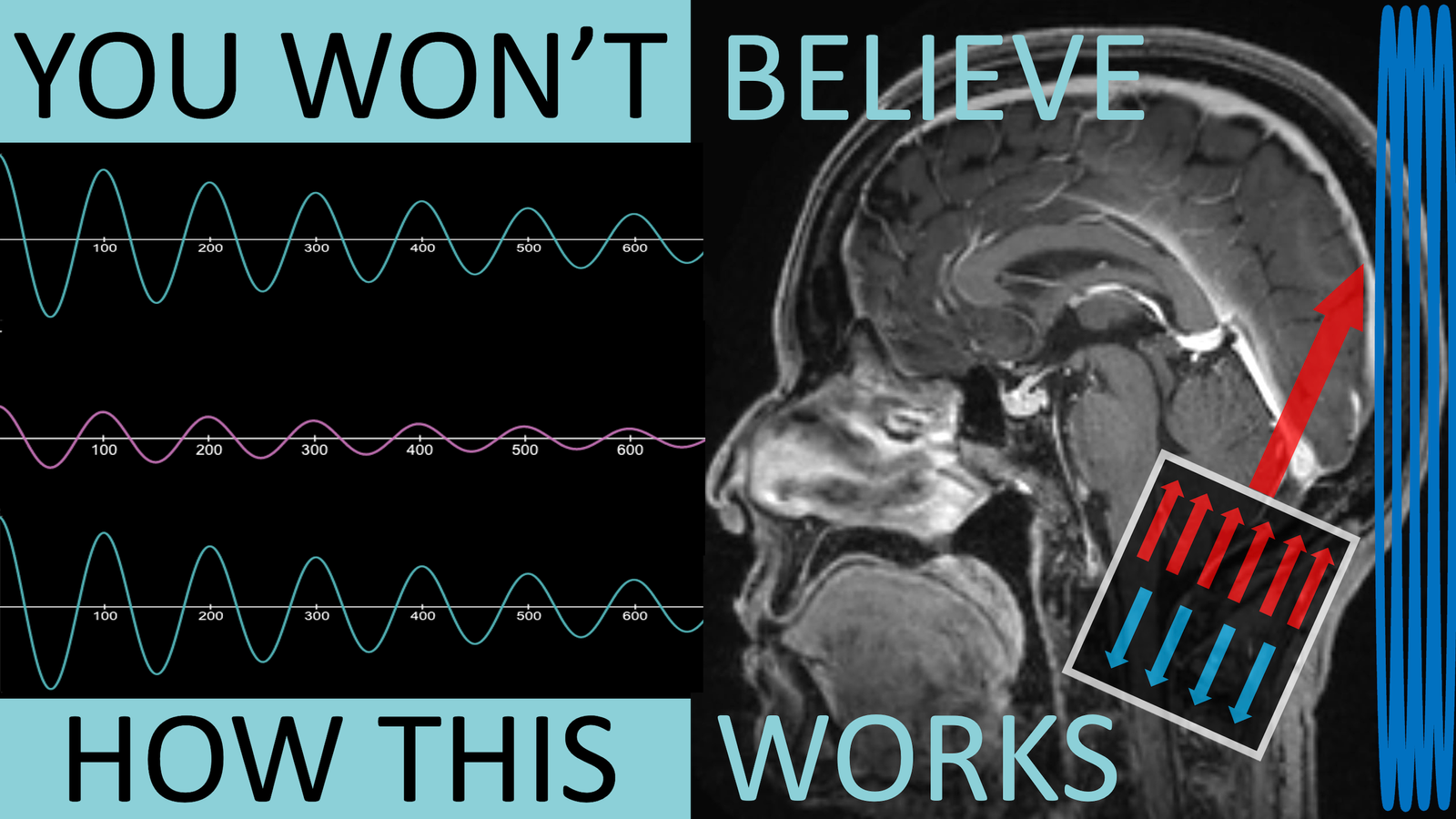 MRI Physics – Radiofreedia.org